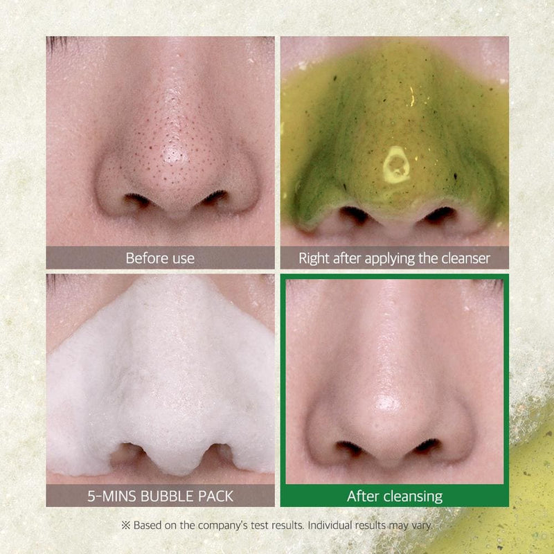 Some By Mi Bye Bye Blackhead 30 Days Miracle Green Tea Tox Bubble Cleanser (120G) -  muj beauty