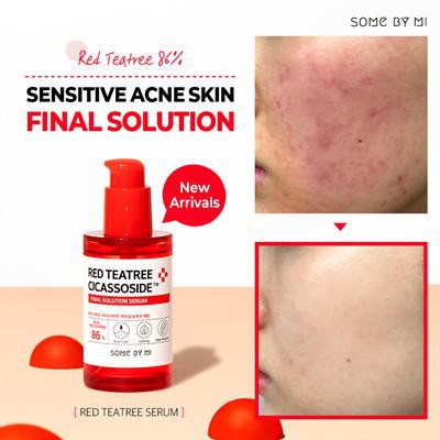 Some By Mi Red Teatree Cicassoside Final Solution Serum (50ML) -  muj beauty